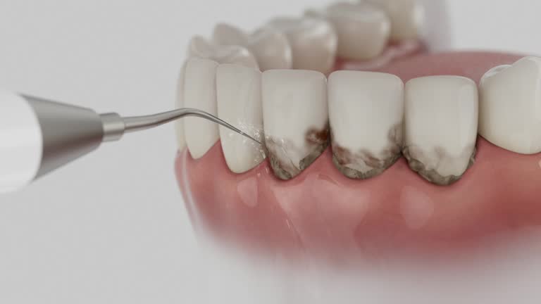 Trusted Tooth Extraction service in Purcellville, VA - Dentist Open Now